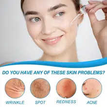 Esencia Serum Botox – Efecto Lifting Inmediato 3